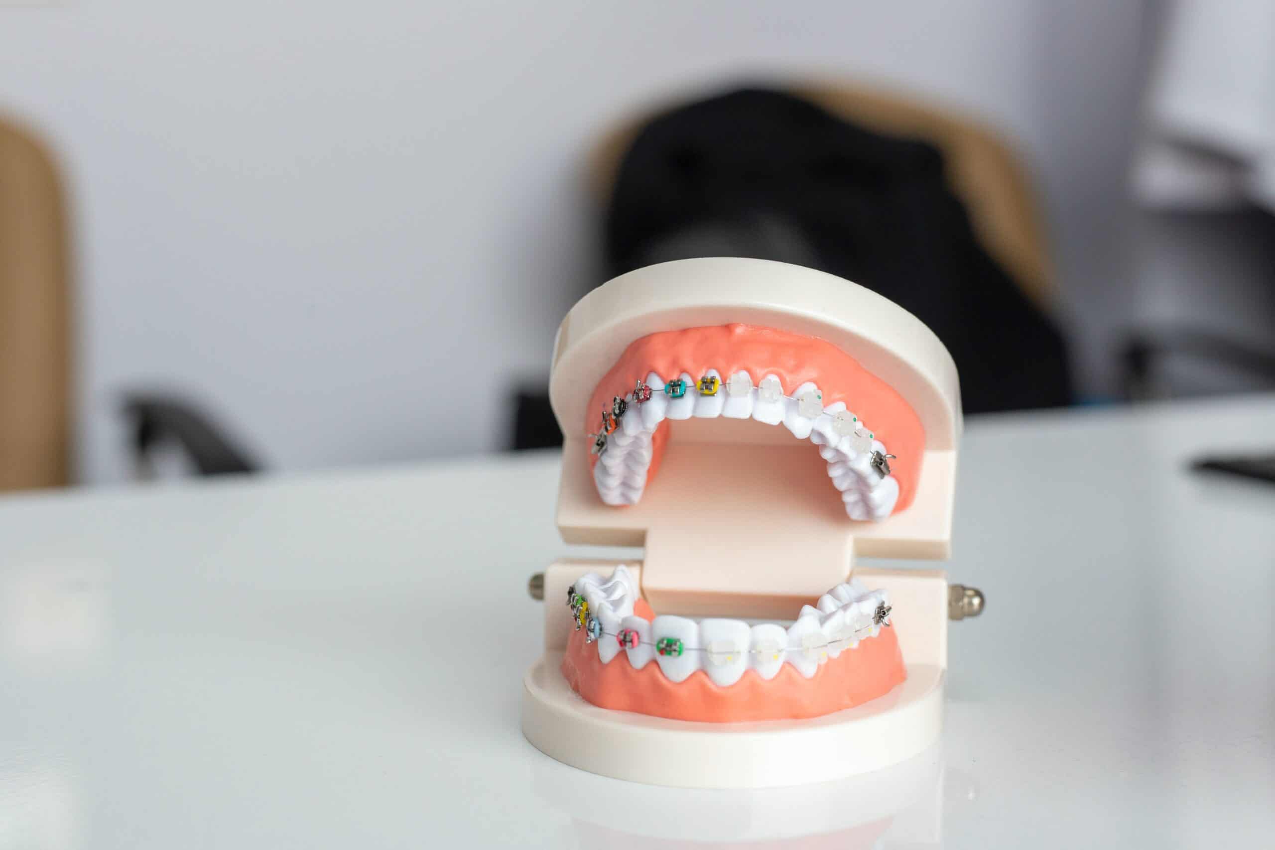 Braces & Brackets