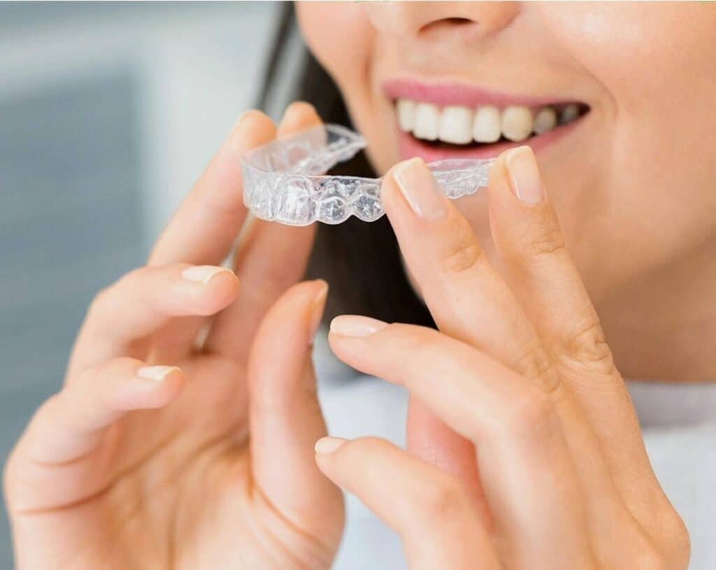 Laster Perfect Smile; clear aligners